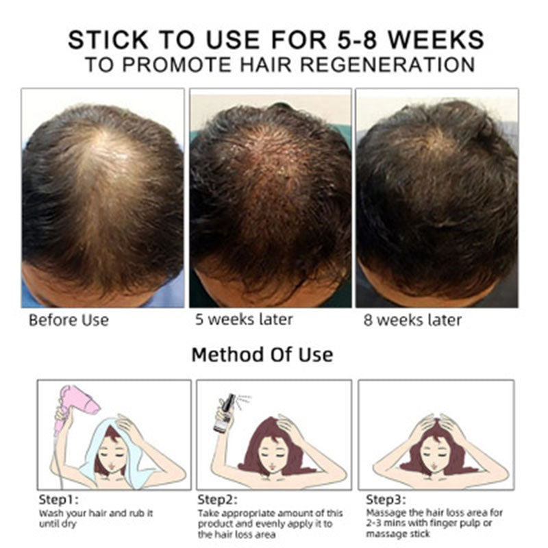 Haarwachstumsöl mit Pflegeformel | Nährendes Hair Care Öl für Kräftiges Haar
