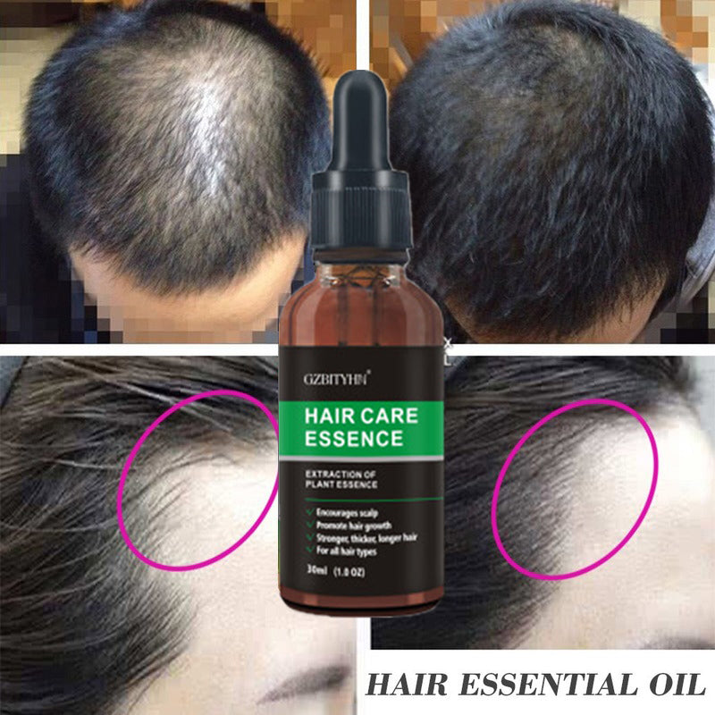 Haarwachstumsöl mit Pflegeformel | Nährendes Hair Care Öl für Kräftiges Haar