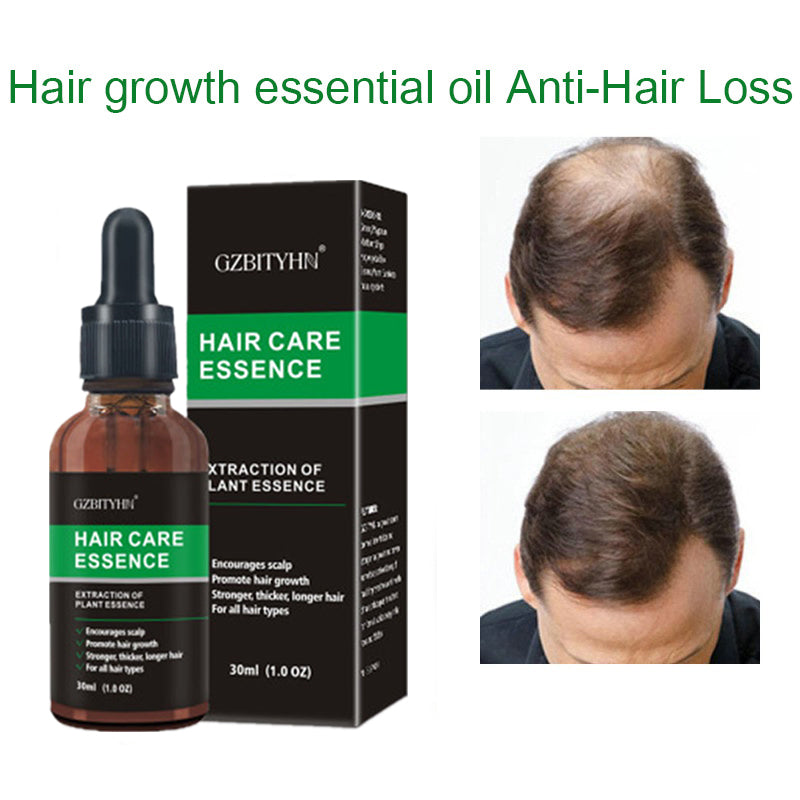 Haarwachstumsöl mit Pflegeformel | Nährendes Hair Care Öl für Kräftiges Haar