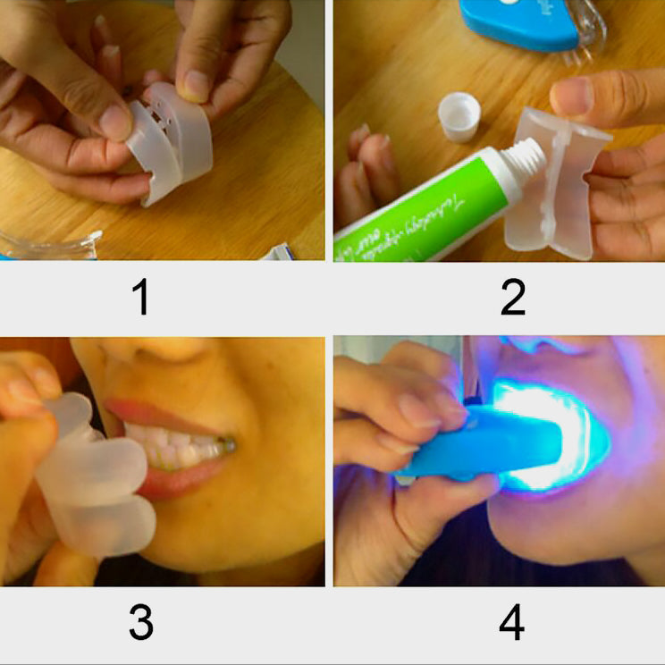 LED Zahnaufhellung Set mit Whitening Gel | Dental Bleaching für Strahlend Weiße Zähne