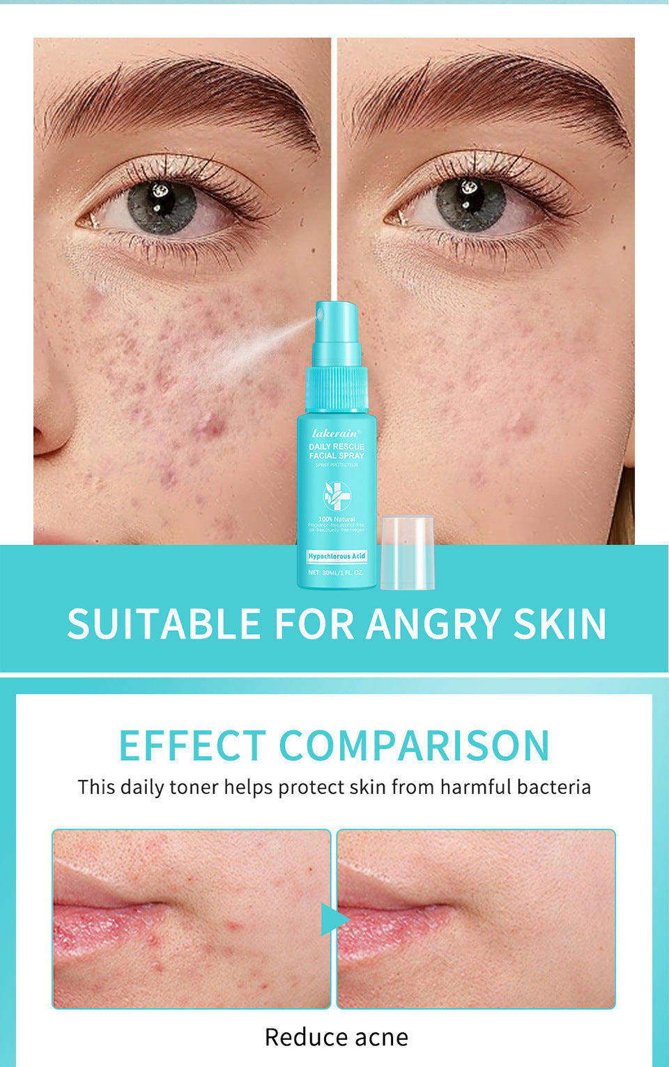 Hypochlorous Facial Spray | Skin-Soothing Care Spray